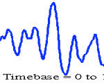 Otoacoustic emissions